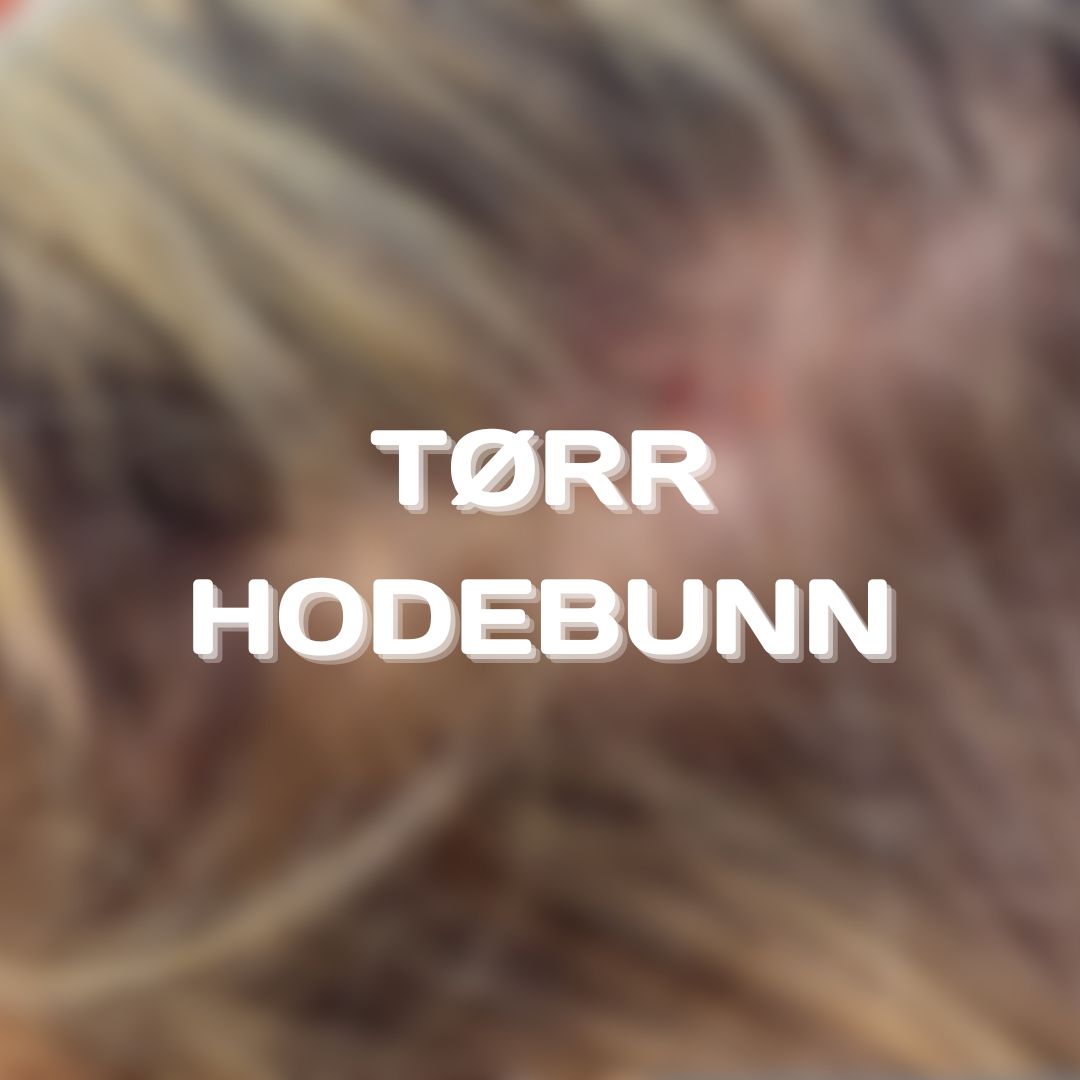 Tørr Hodebunn
